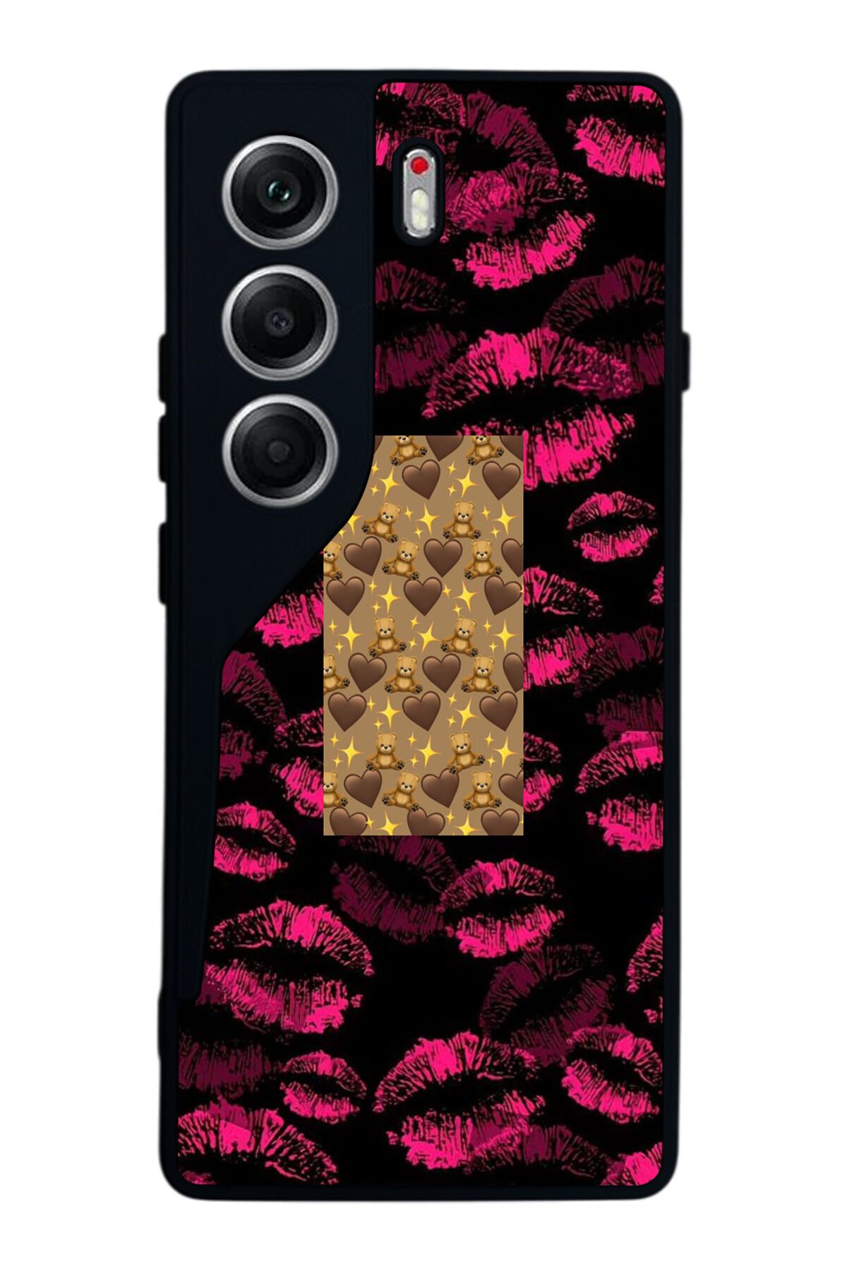Tecno Camon 40 Uyumlu Dudak Tasarımlı Glossy Premium Kılıf