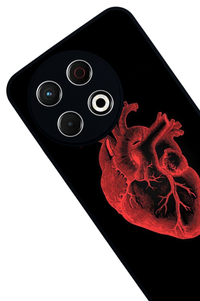 Tecno Spark 30 Pro Uyumlu Kalp Love Tasarımlı Glossy Premium Kılıf