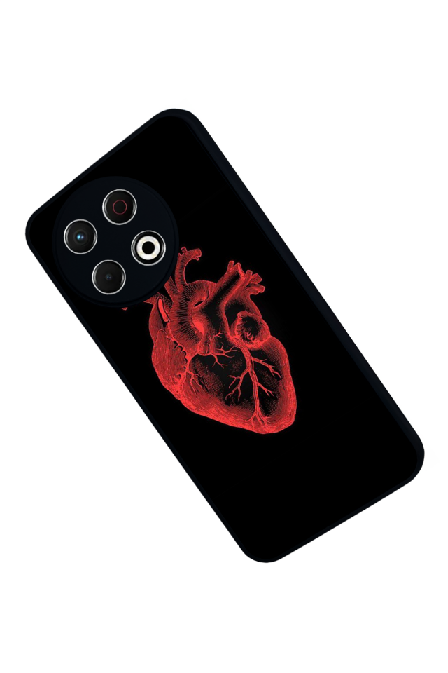 Tecno Spark 30 Pro Uyumlu Kalp Love Tasarımlı Glossy Premium Kılıf