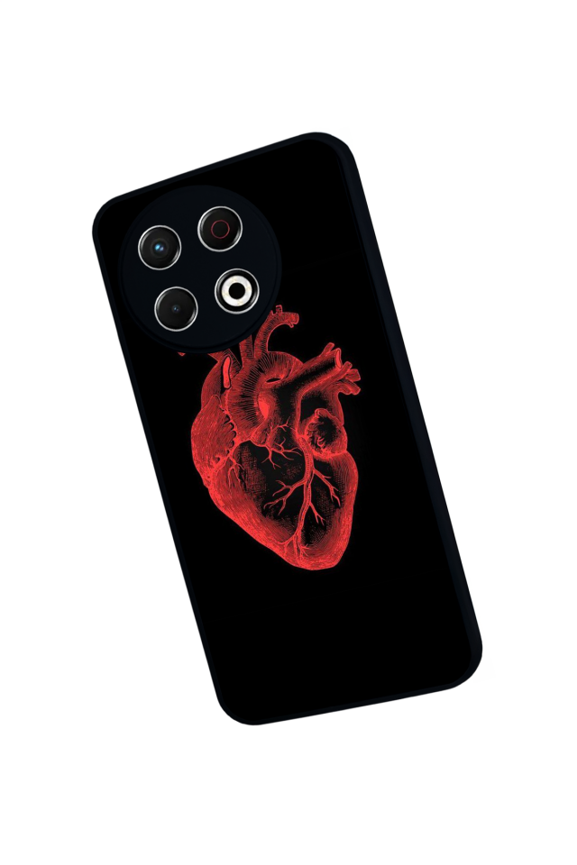 Tecno Spark 30 Pro Uyumlu Kalp Love Tasarımlı Glossy Premium Kılıf