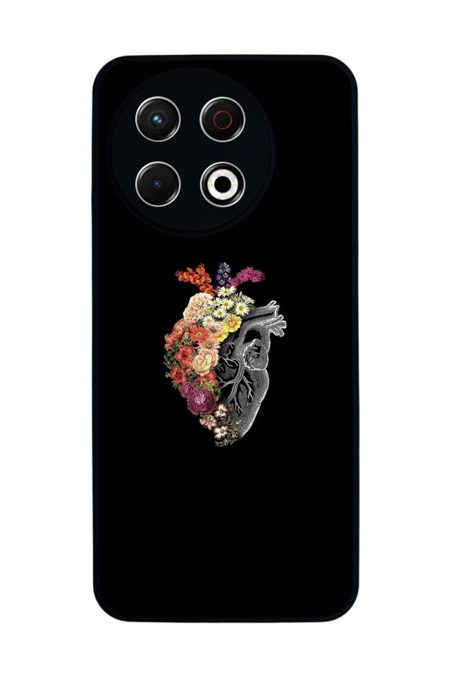 Tecno Spark 30 Pro Uyumlu Kalp Love Tasarımlı Glossy Premium Kılıf