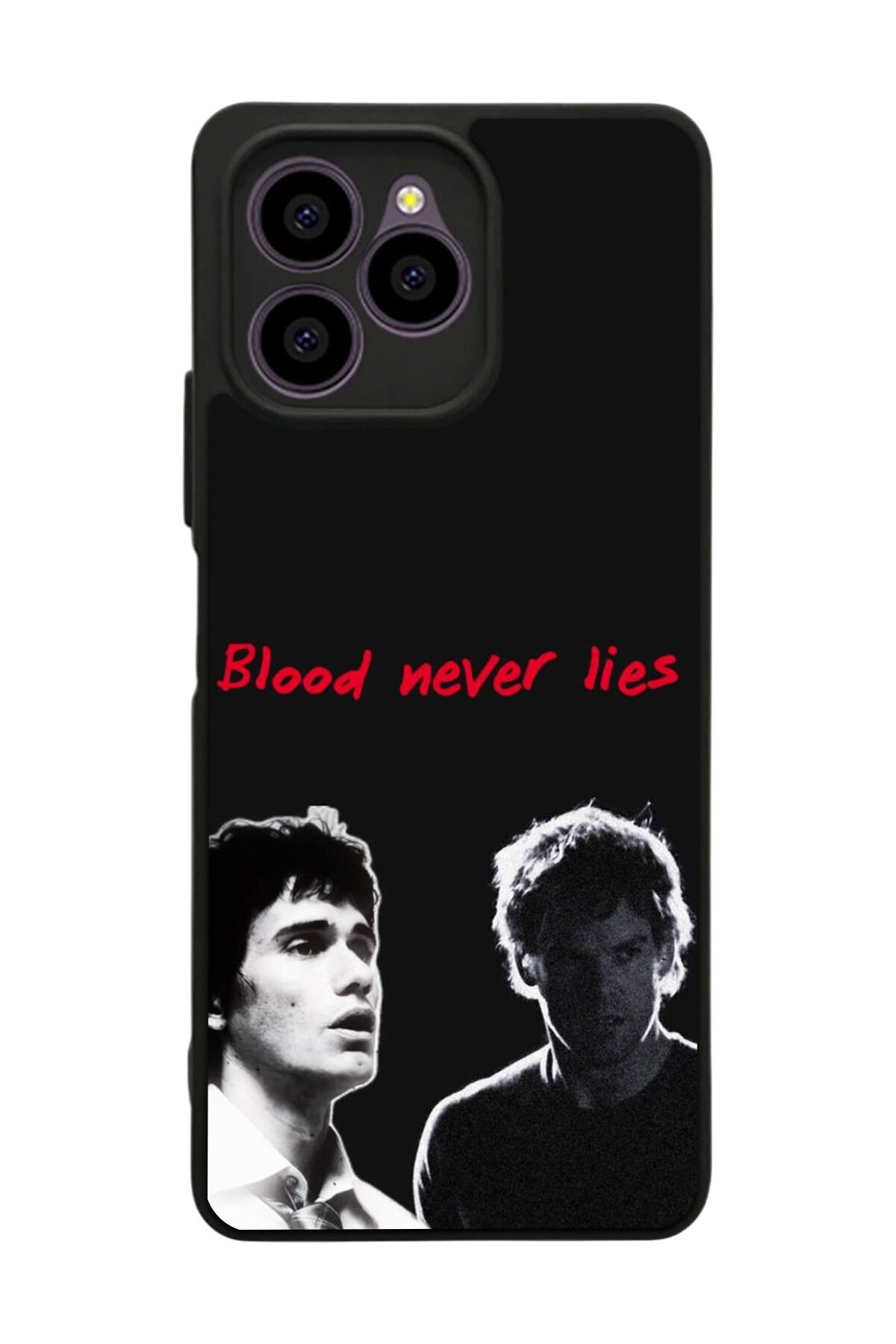 Omix X6 Uyumlu DeOmix Omix X6ter Tasarımlı Glossy Premium Kılıf