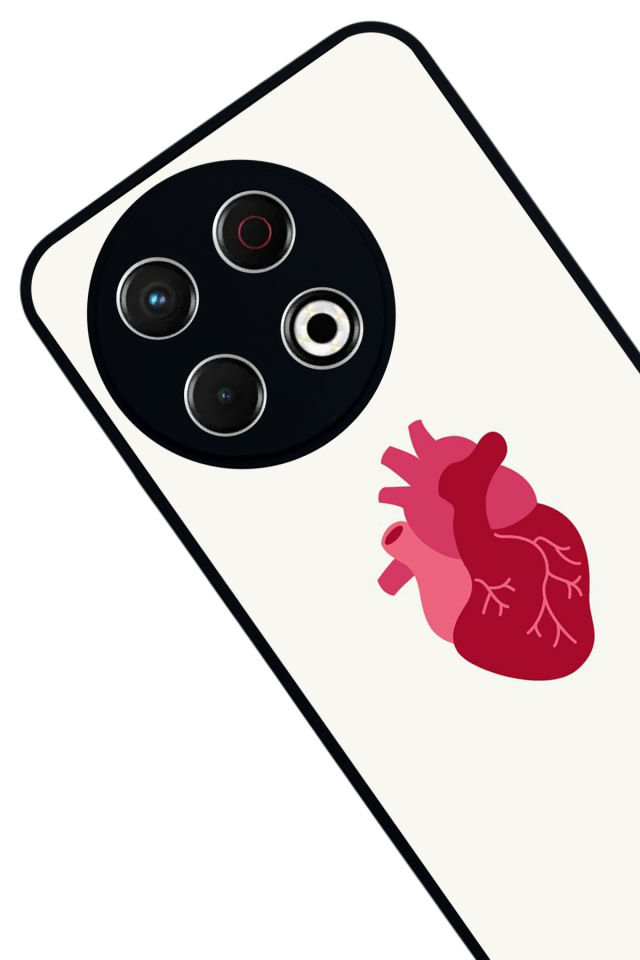 Tecno Spark 30 Pro Uyumlu Kalp Love Tasarımlı Glossy Premium Kılıf