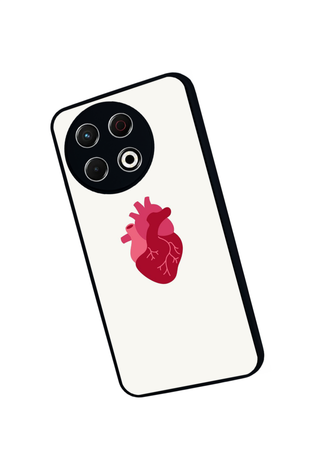 Tecno Spark 30 Pro Uyumlu Kalp Love Tasarımlı Glossy Premium Kılıf