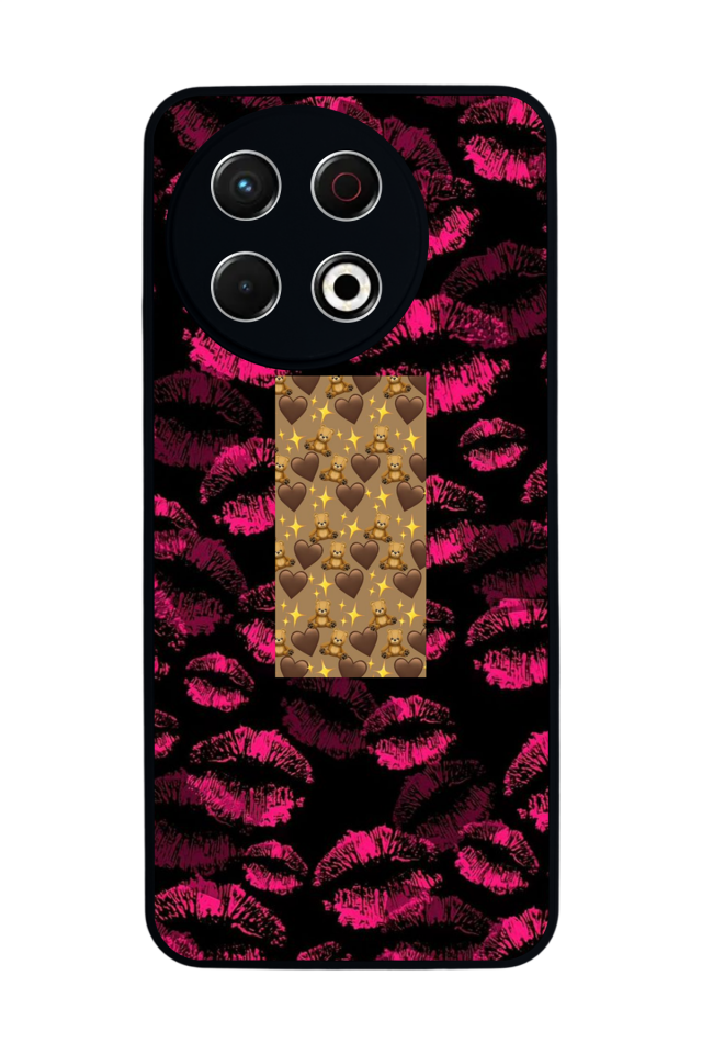 Tecno Spark 30 Pro Uyumlu Dudak Tasarımlı Glossy Premium Kılıf