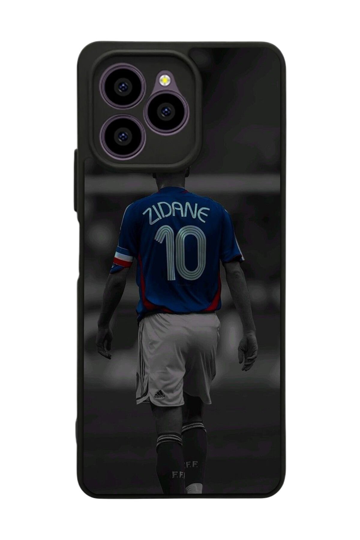 Omix X6 Uyumlu Zidane Tasarımlı Glossy Premium Kılıf