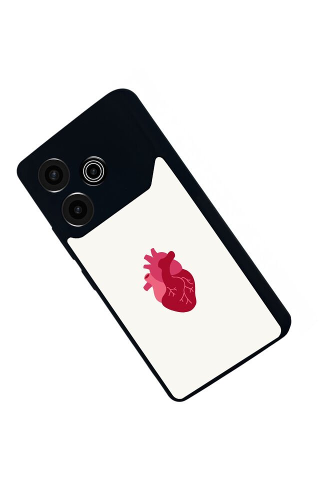 Tecno Pova 6 Uyumlu Kalp Love Tasarımlı Glossy Premium Kılıf