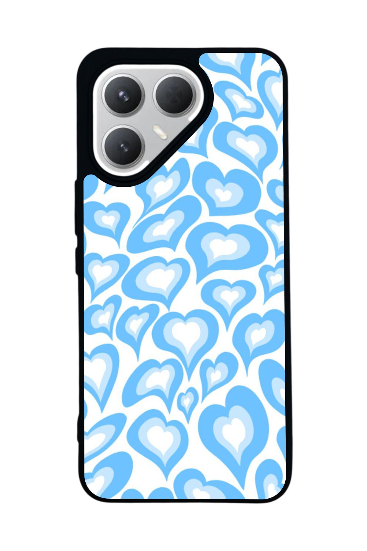 Tecno Pova 7 Pro Mat Uyumlu Siyah Kılıf – Yumuşak Silikon, Koruyucu, Şok Emici Kapak