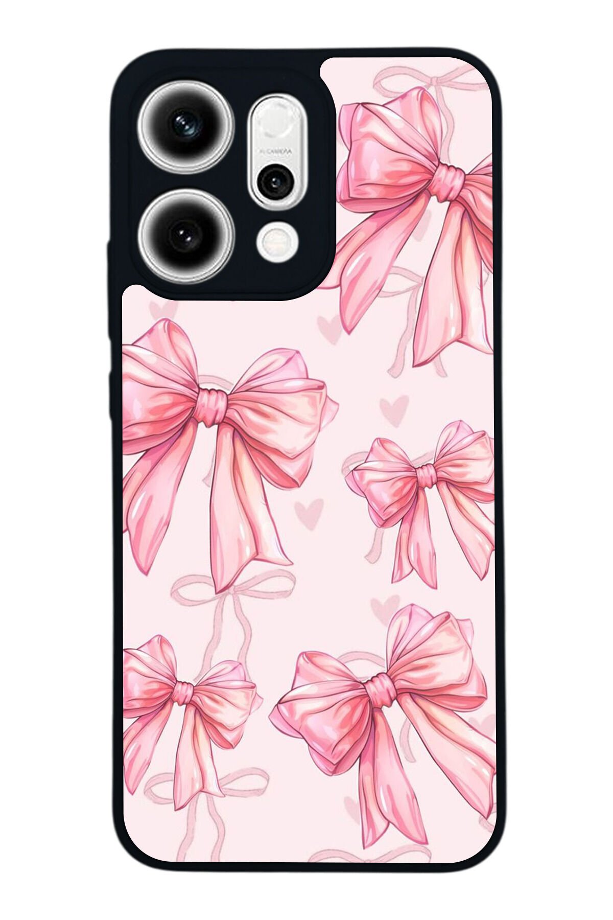 Oppo Reno 14 Uyumlu Kurdele Tasarımlı Glossy Premium Kılıf