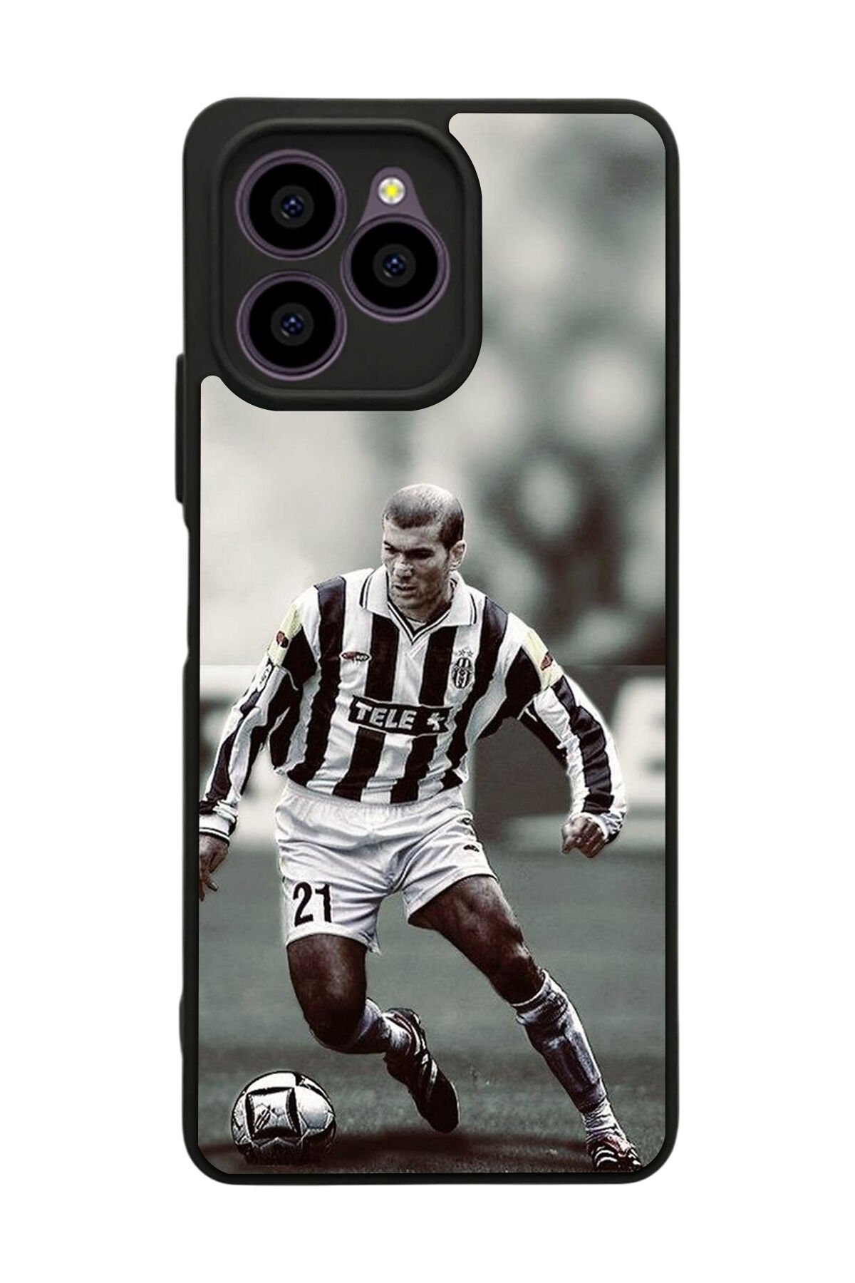 Omix X6 Uyumlu Zidane Tasarımlı Glossy Premium Kılıf