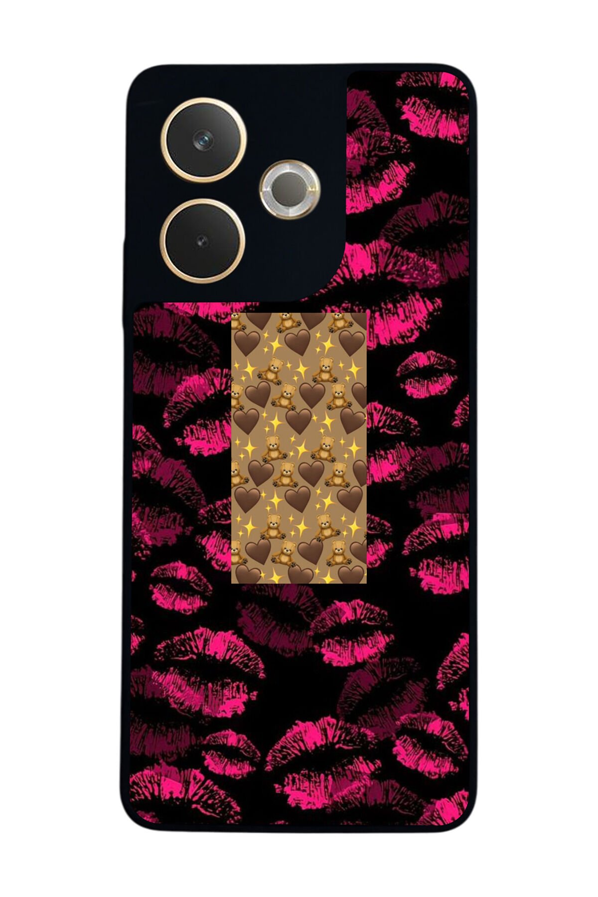 Oppo A5 Pro Uyumlu Dudak Tasarımlı Glossy Premium Kılıf