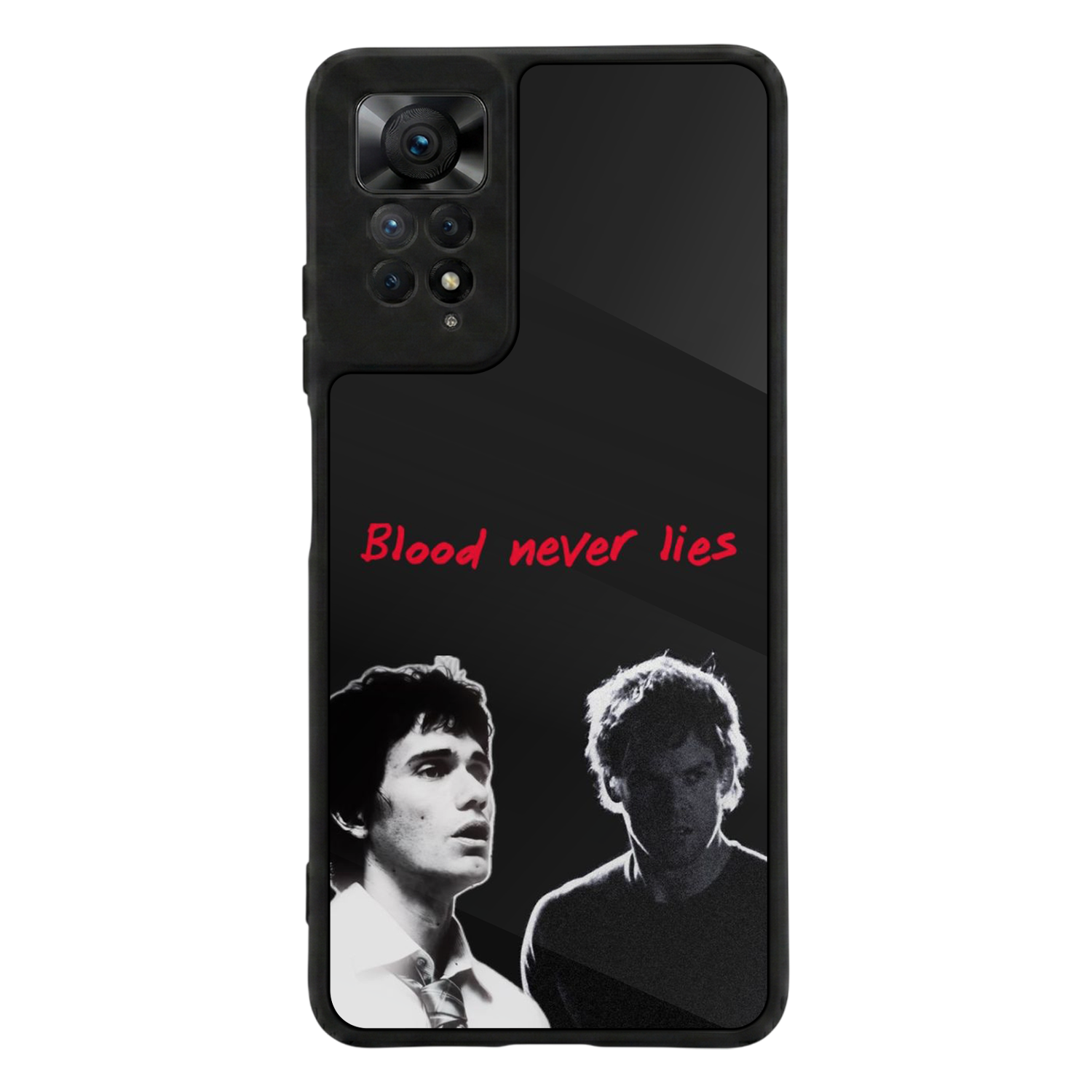 Xiaomi Redmi Note 11 Pro Uyumlu DeXiaomi Redmi Note 11 Proter Tasarımlı Glossy Premium Kılıf