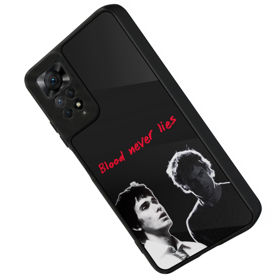 Xiaomi Redmi Note 11 Pro Uyumlu DeXiaomi Redmi Note 11 Proter Tasarımlı Glossy Premium Kılıf