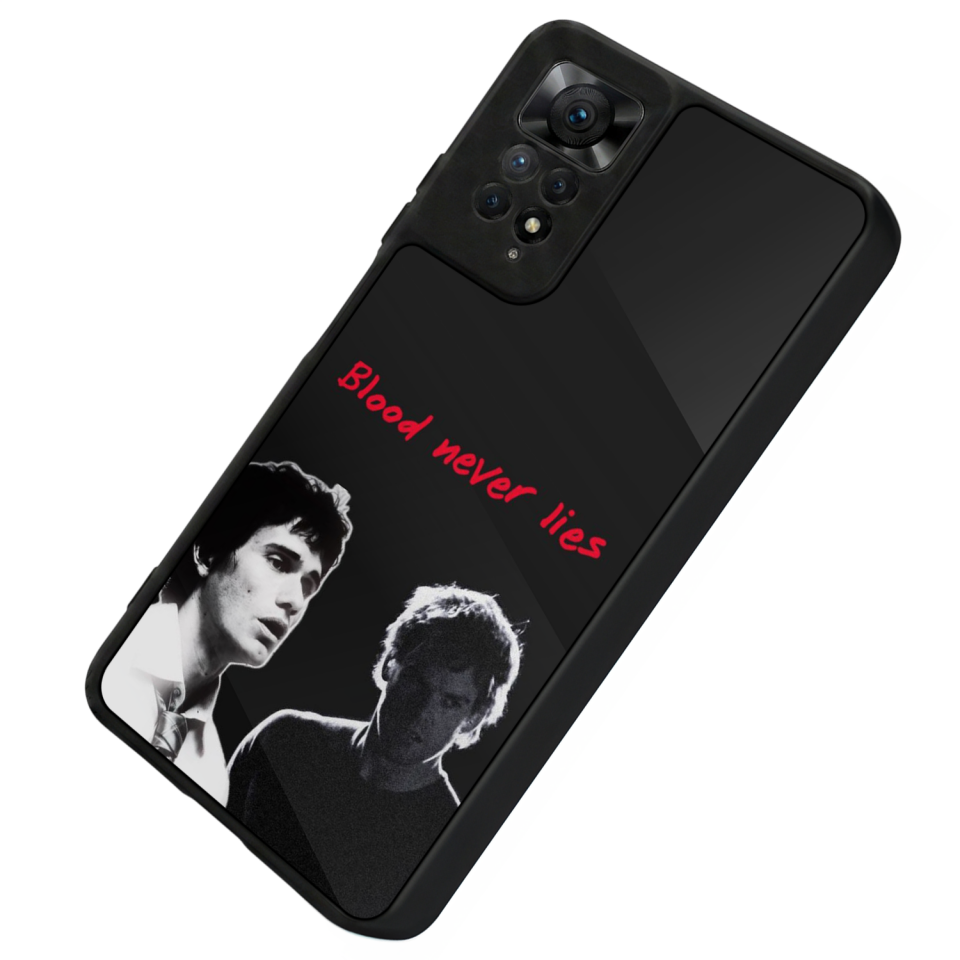 Xiaomi Redmi Note 11 Pro Uyumlu DeXiaomi Redmi Note 11 Proter Tasarımlı Glossy Premium Kılıf
