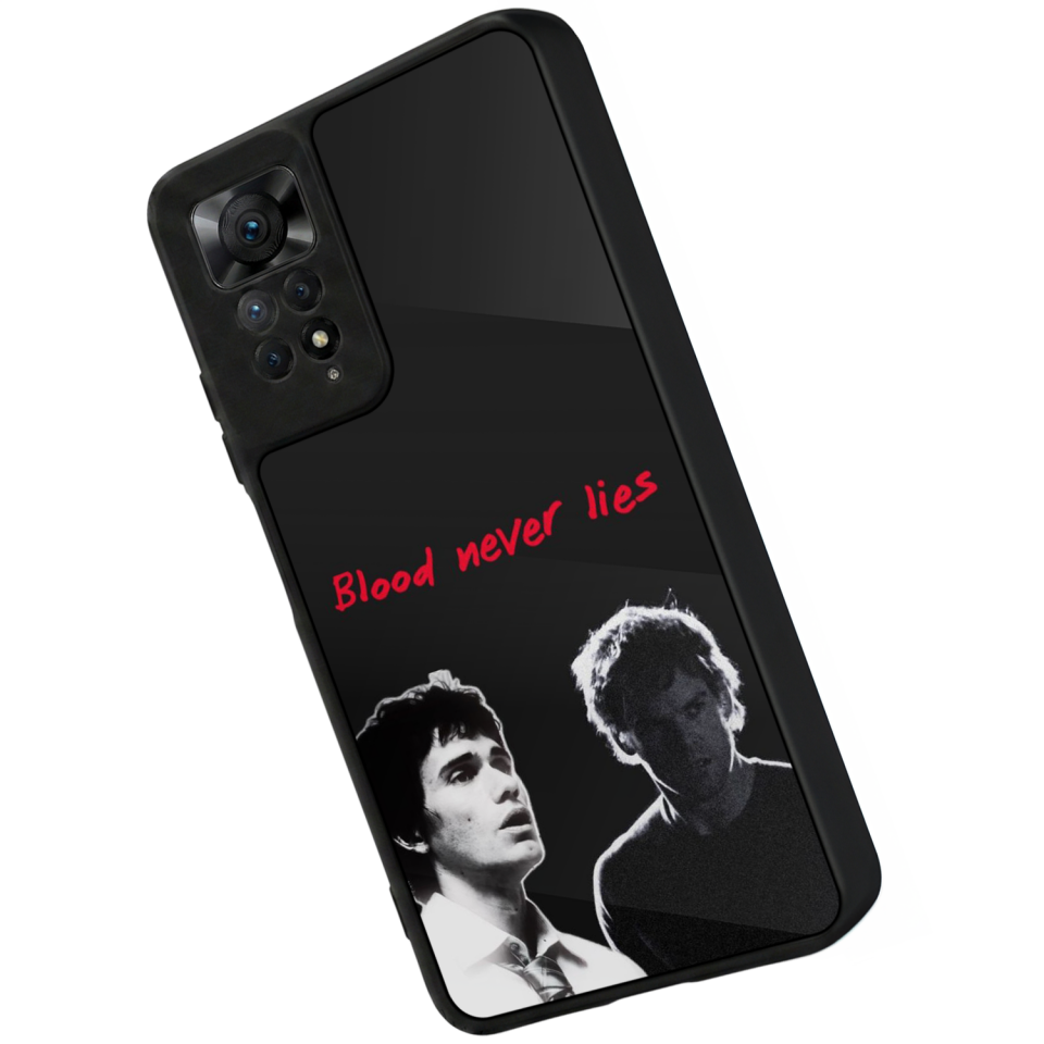 Xiaomi Redmi Note 11 Pro Uyumlu DeXiaomi Redmi Note 11 Proter Tasarımlı Glossy Premium Kılıf
