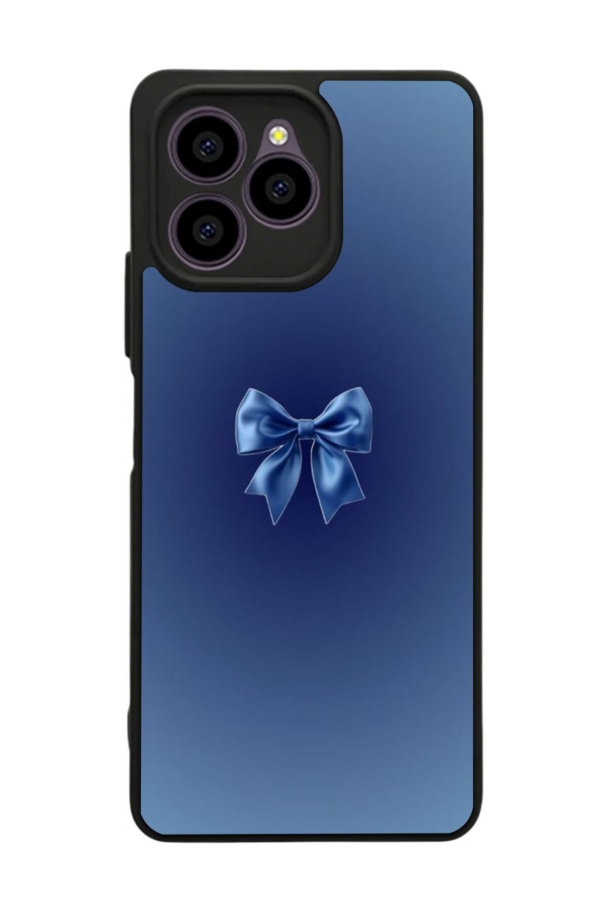 Omix X6 Uyumlu Kurdele Tasarımlı Glossy Premium Kılıf