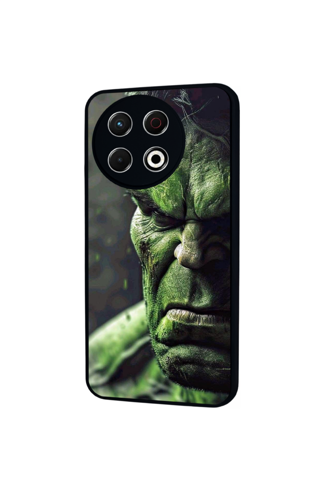 Tecno Spark 30 Pro Uyumlu Hulk Tasarımlı Glossy Premium Kılıf