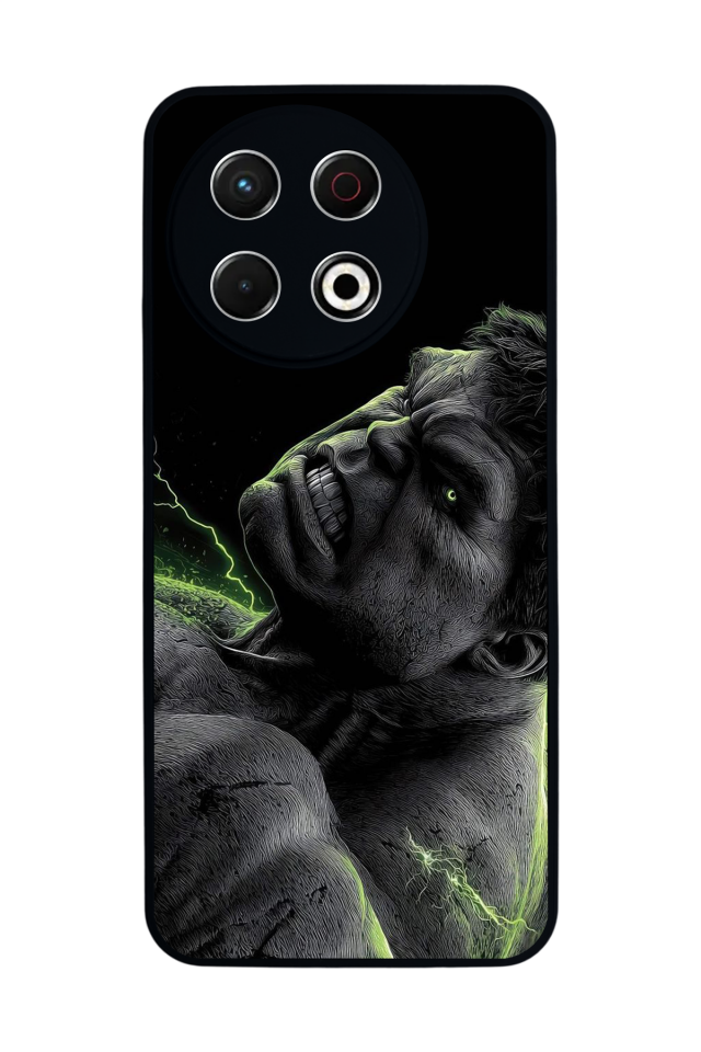 Tecno Spark 30 Pro Uyumlu Wolverine Tasarımlı Glossy Premium Kılıf