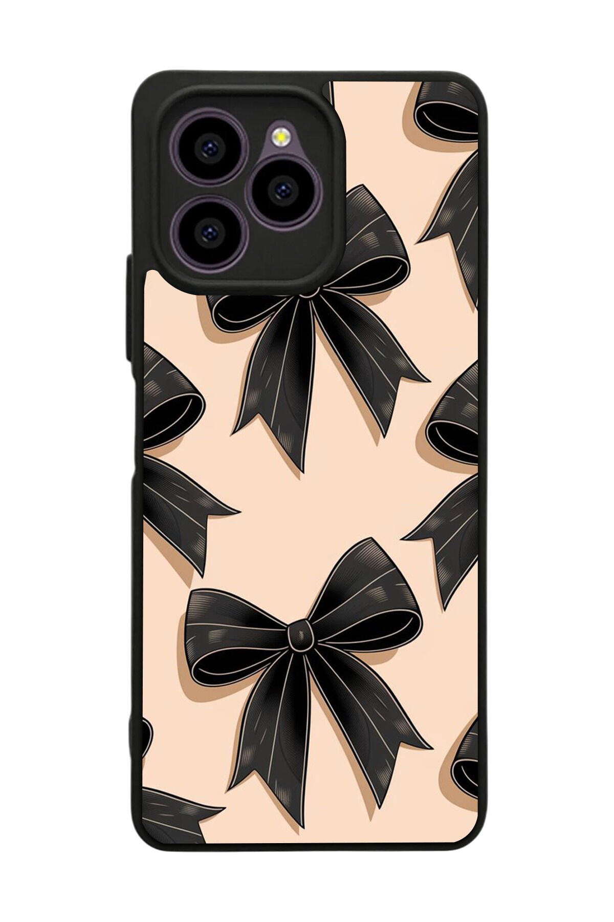 Omix X6 Uyumlu Kurdele Tasarımlı Glossy Premium Kılıf