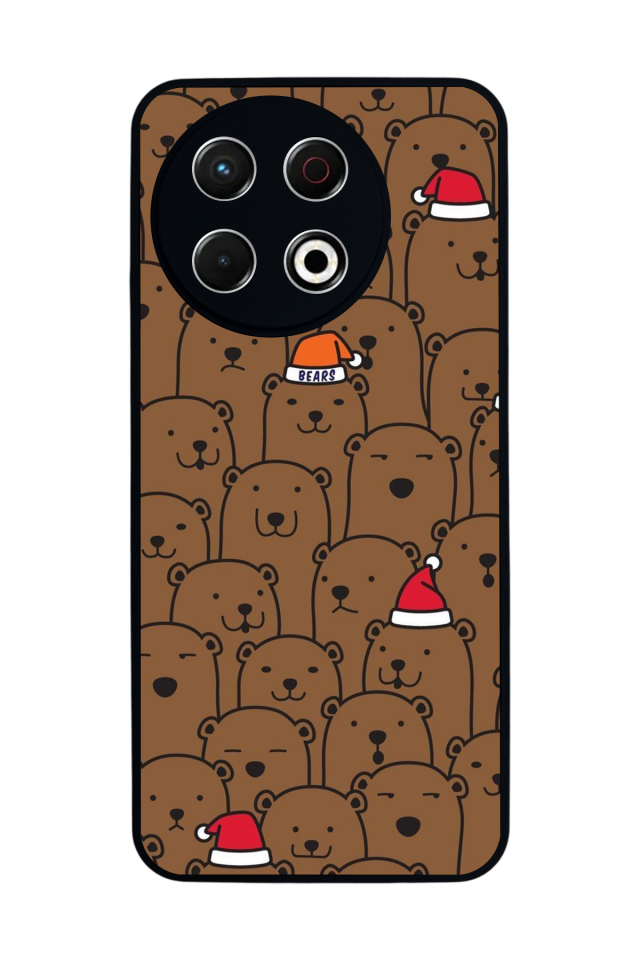 Tecno Spark 30 Pro Uyumlu Yılan Tasarımlı Glossy Premium Kılıf