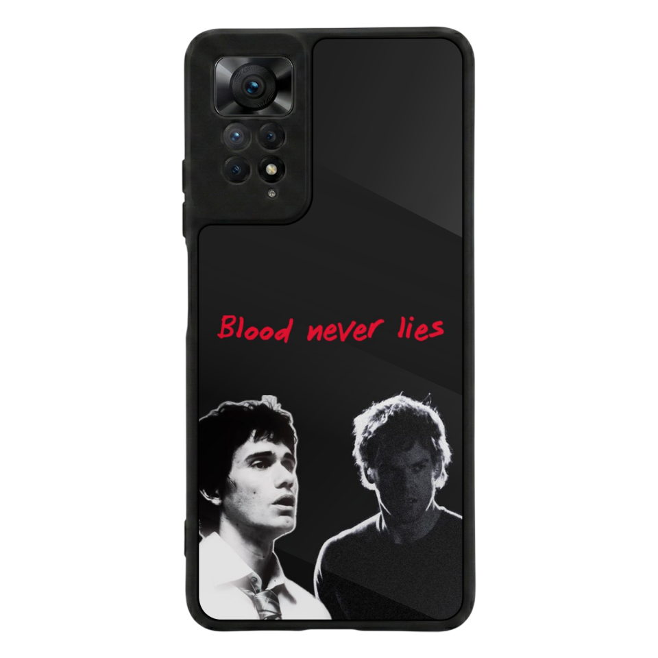 Xiaomi Redmi Note 12 Pro Uyumlu DeXiaomi Redmi Note 12 Proter Tasarımlı Glossy Premium Kılıf