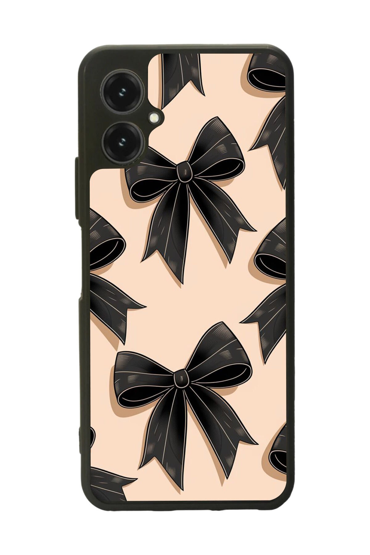 Omix X5 Uyumlu Kurdele Tasarımlı Glossy Premium Kılıf