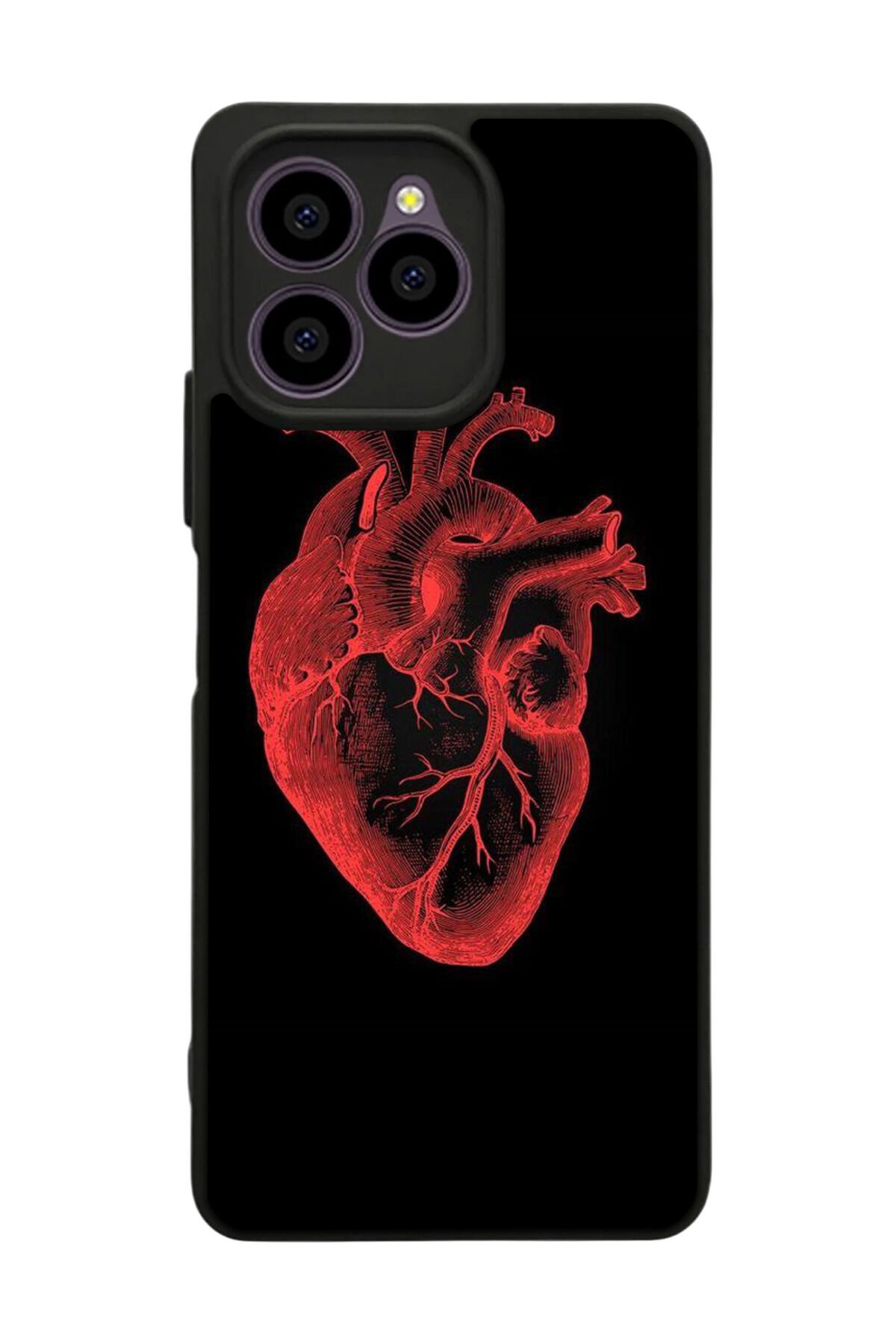 Omix X6 Uyumlu Kalp Love Tasarımlı Glossy Premium Kılıf