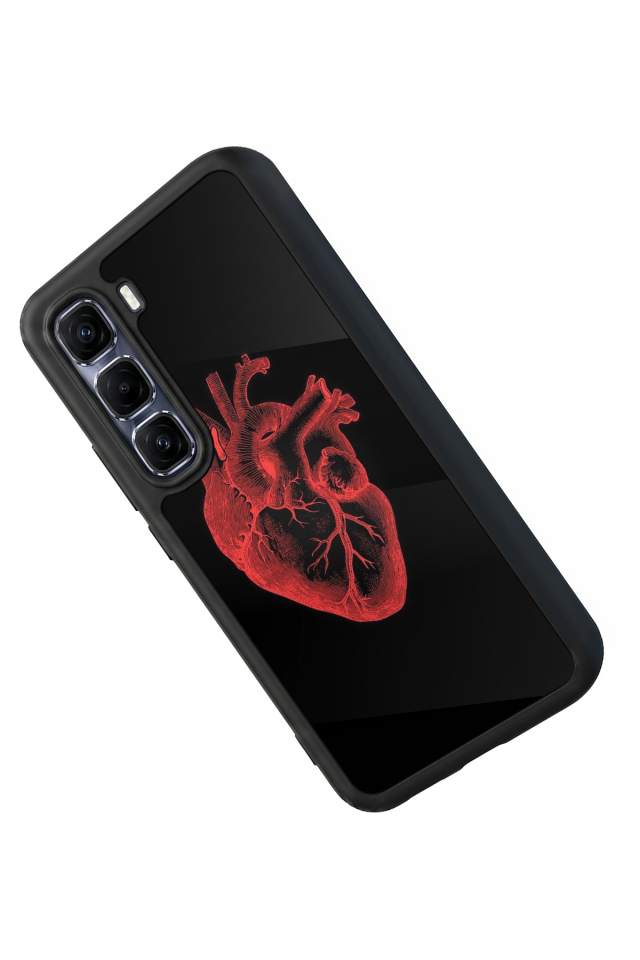 Infinix Hot 60 Pro Plus Uyumlu Kalp Love Tasarımlı Glossy Premium Kılıf