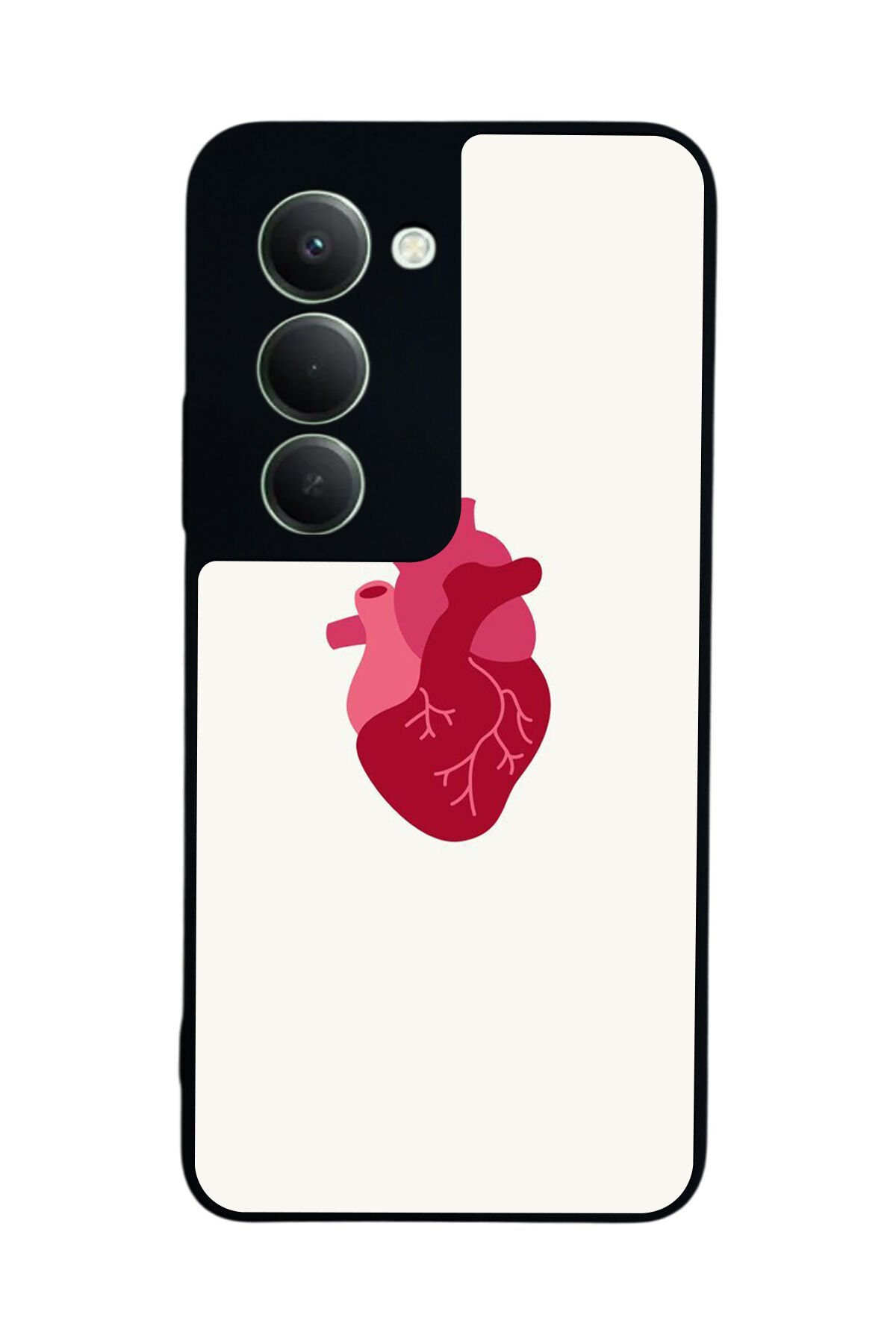 Xiaomi Redmi 15 5G Uyumlu Kalp Love Tasarımlı Glossy Premium Kılıf