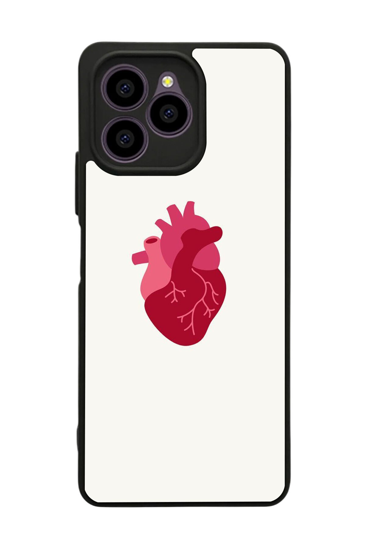 Omix X6 Uyumlu Kalp Love Tasarımlı Glossy Premium Kılıf