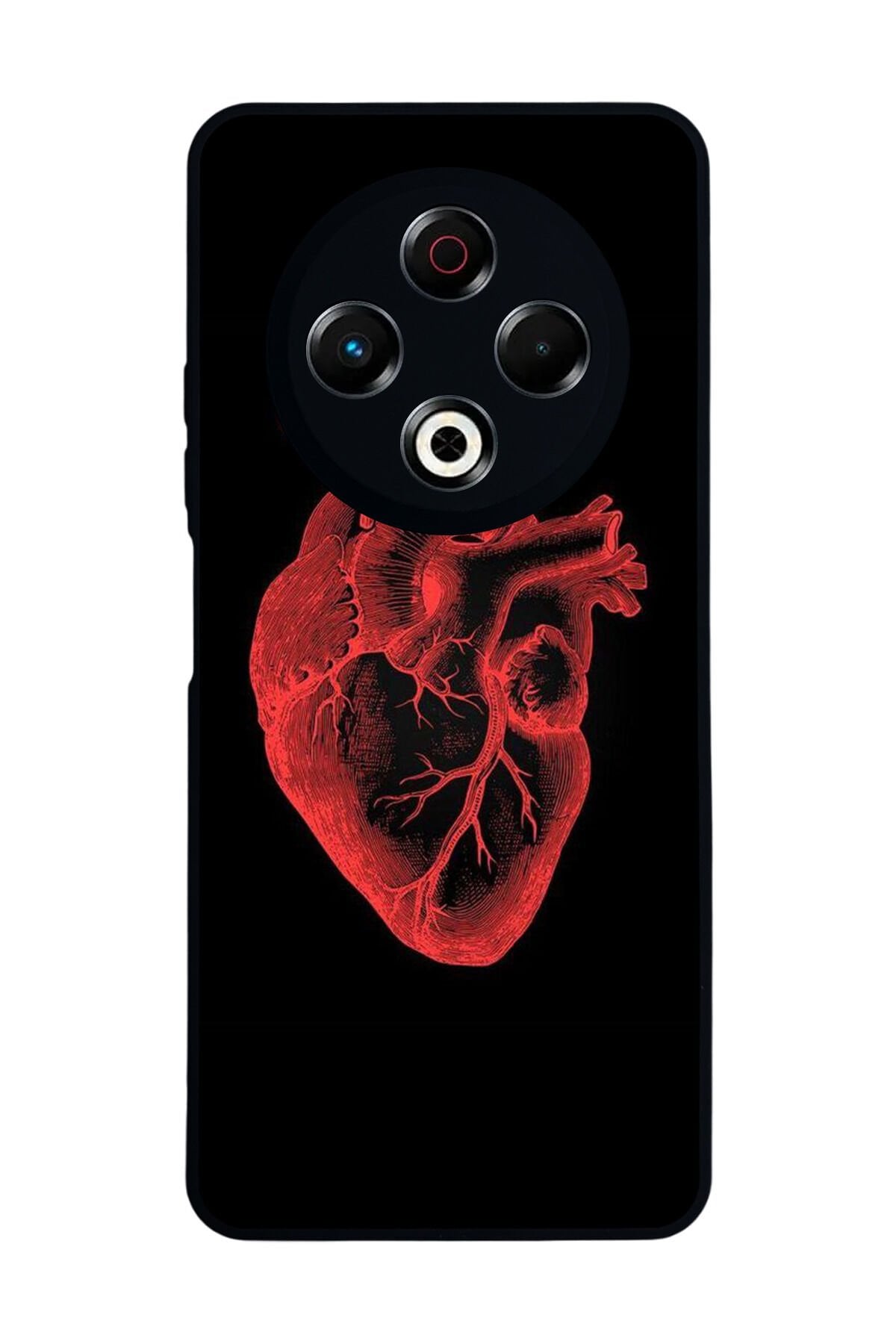 Tecno Spark 30 Uyumlu Kalp Love Tasarımlı Glossy Premium Kılıf